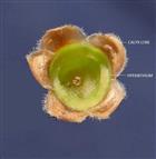  Hypanthium and Calyx